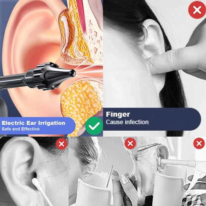 Sollievo Ear Cleaning Irrigation Tool